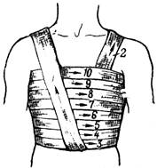 Спиральная повязка груди